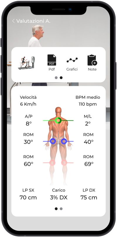 Gait Analysis